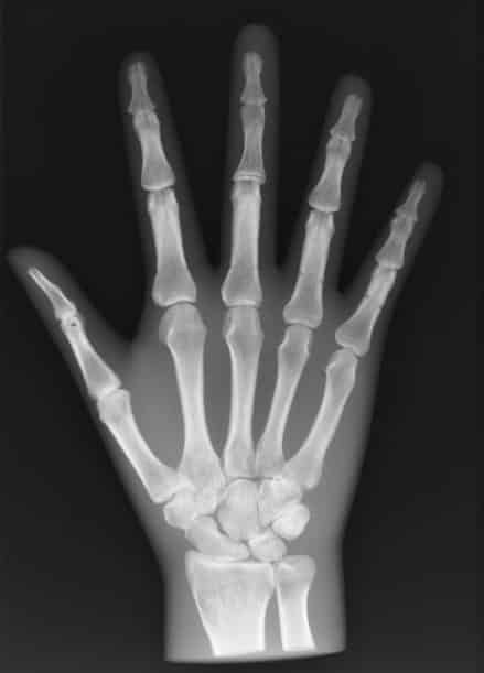 Una radiografia alla mano